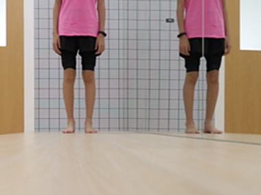 3.步態動態評估