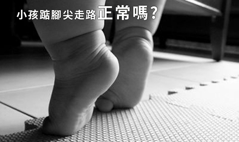 小孩踮腳尖走路正常嗎?