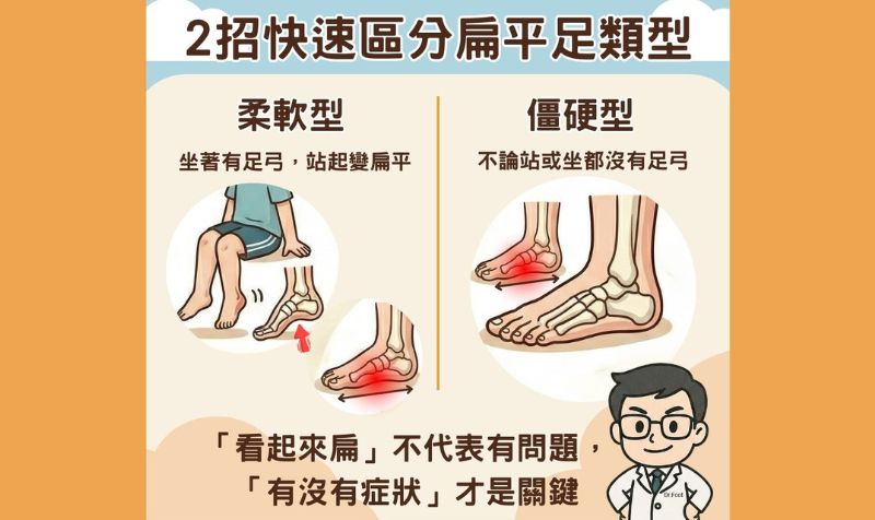 兒童扁平足怎麼看？功能型與結構型差在哪，什麼情況要評估