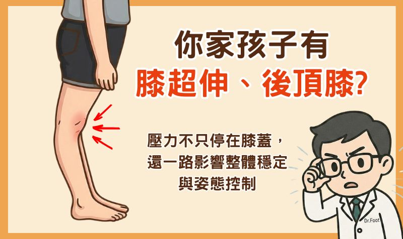 孩子站姿膝蓋往後頂？認識膝超伸／後頂膝與下肢穩定問題