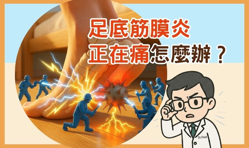 足底筋膜炎正在痛怎麼辦？急性期處理方式與鞋墊怎麼幫忙